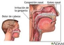 congestion nasal