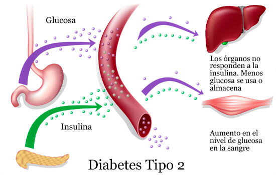 cura para diabeticos tipo 2