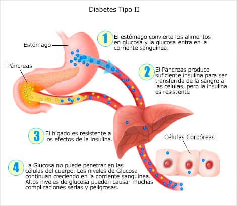 informacion para diabeticos tipo 2