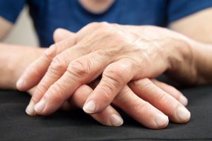 los medicamentos naturales para la artritis
