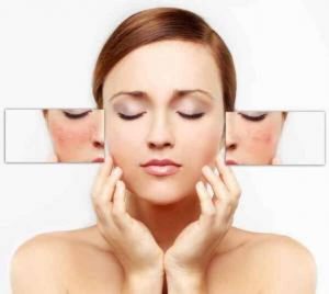 6 tips para disminuir las manchas faciales